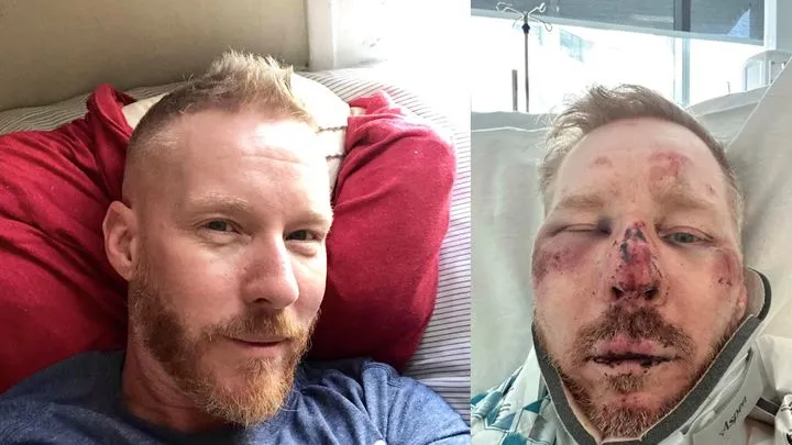 Gay Man Assaulted and Robbed Outside San Francisco Leather Bar